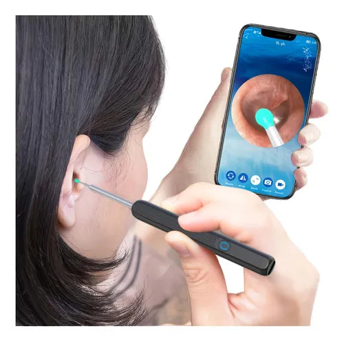 Limpiador auditivo Smart con Camara🎥 - Otoscopio Premium