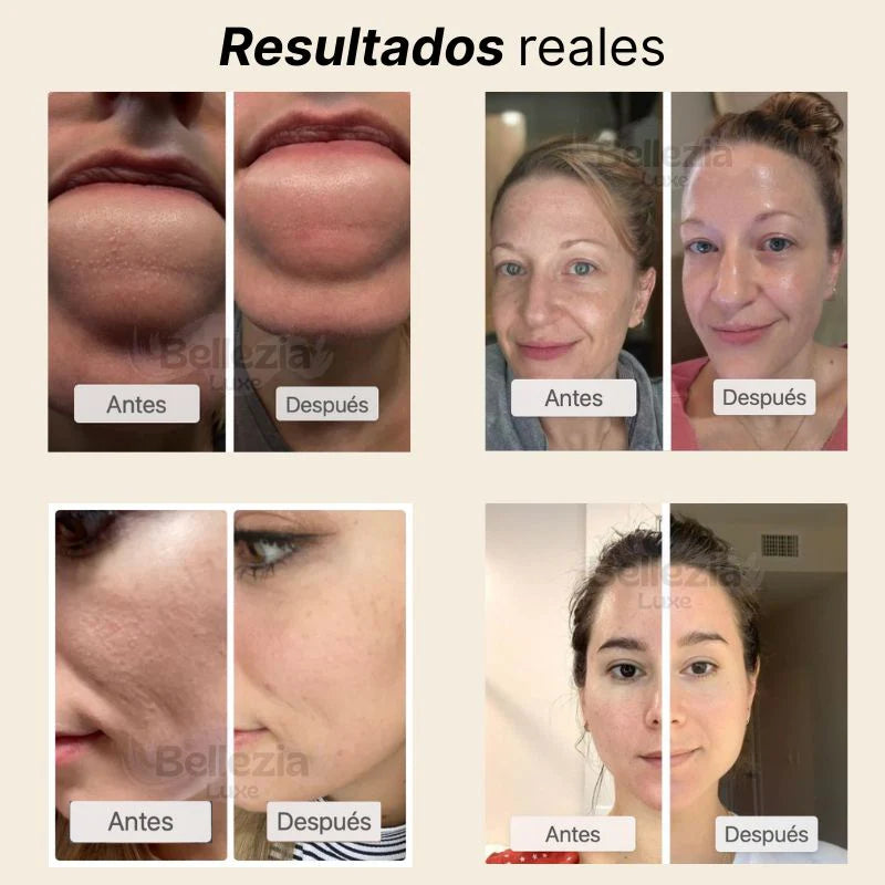 Dr.Melaxin Dúo facial de arroz