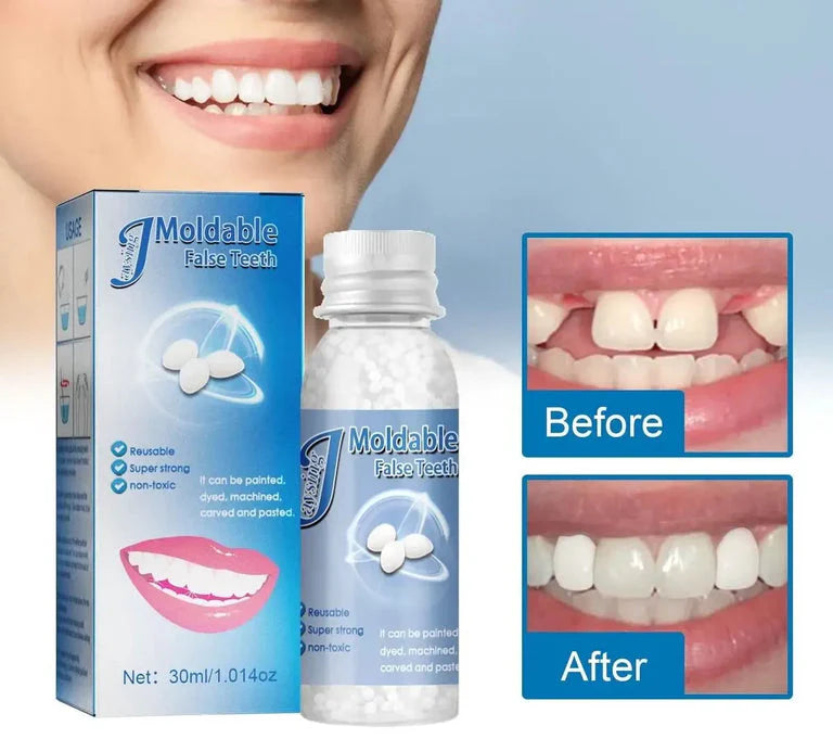 Resina Dental Moldeable: Sonríe Sin Miedo