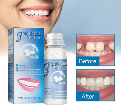 Resina Dental Moldeable: Sonríe Sin Miedo